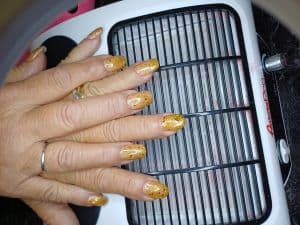 Ricostruzione con tip