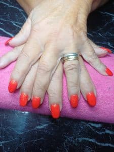 Gel overlay